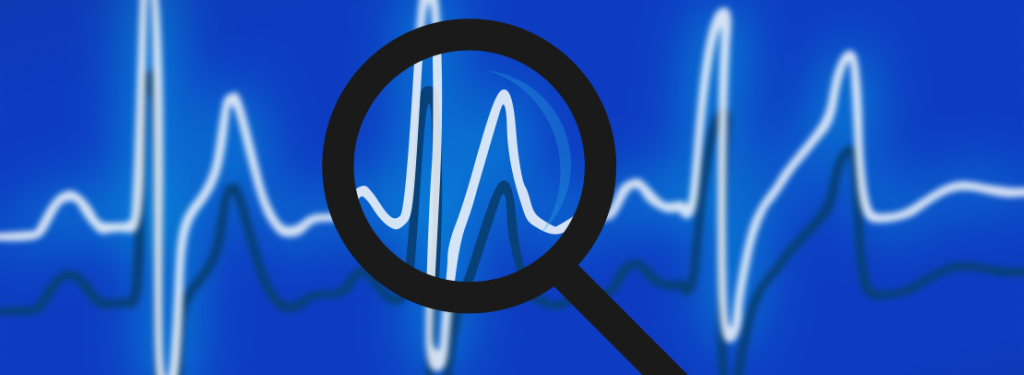 Telemetry Hacking Building a host telemetry solution using Tailscale | APNIC Blog